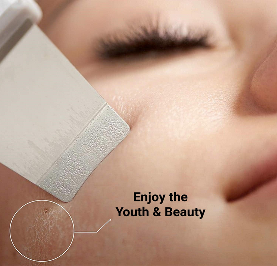 Ultrasonic Skin Scrubber – Deep Cleansing & Blackhead Remover